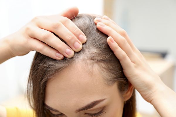 Thinning or Hair Loss Solutions in Peckham